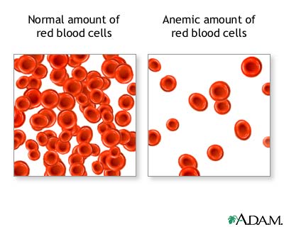 Red blood cells - anemic